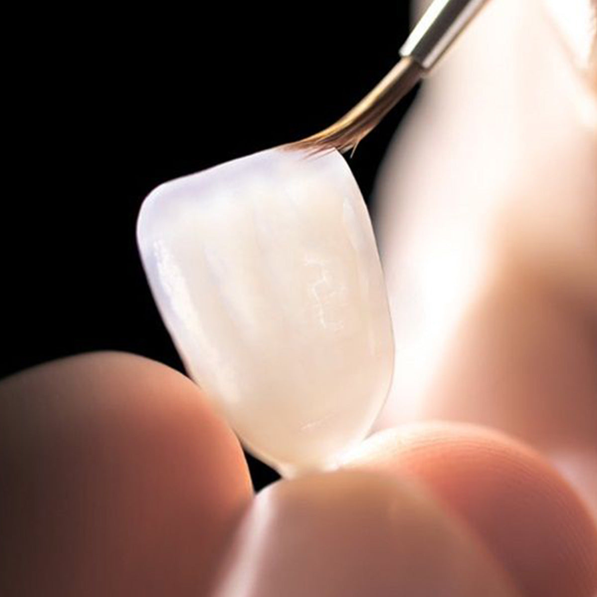 The "Three Pillars" of Anterior Aesthetic Restoration: An In-Depth Analysis of Indications for Monolithic Zirconia, Lithium disilicate blocks, and Hybrid ceramics