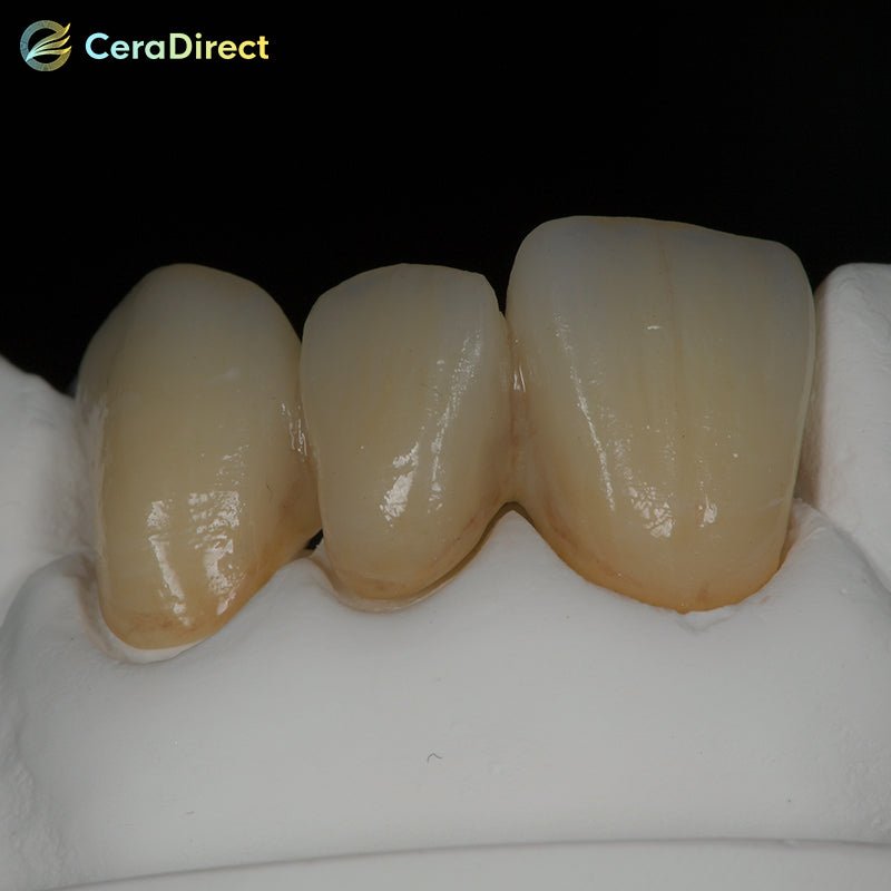 SHT+Multilayer— Multilayer Zirconia Disc AG System (71mm) - CeraDirect